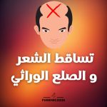 خطة متابعة لتساقط الشعر و الصلع الوراثي