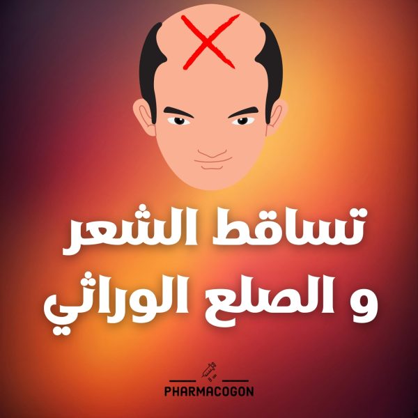 خطة متابعة لتساقط الشعر و الصلع الوراثي